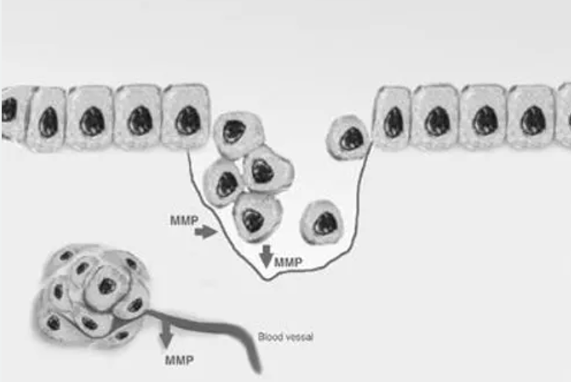 MMP（Matrix Metalloproteinases)のイメージ