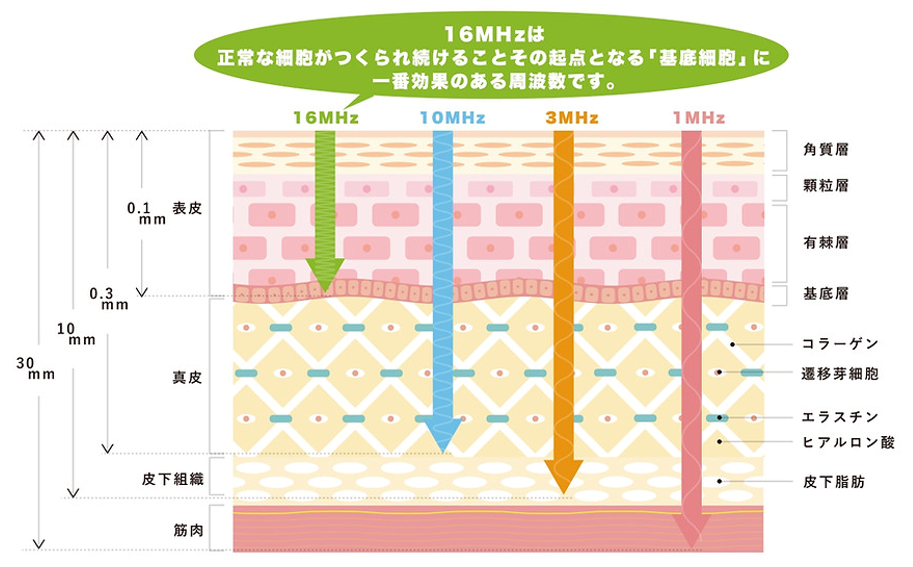 ​各周波数の深さと特徴１イメージ