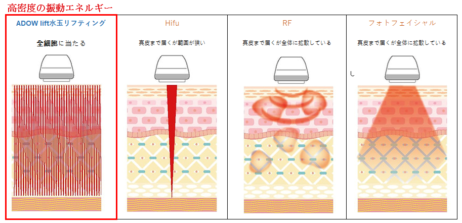 ​各周波数の深さと特徴２イメージ